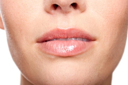 Picture of Cold Sores (Fever Blisters) - WebMD