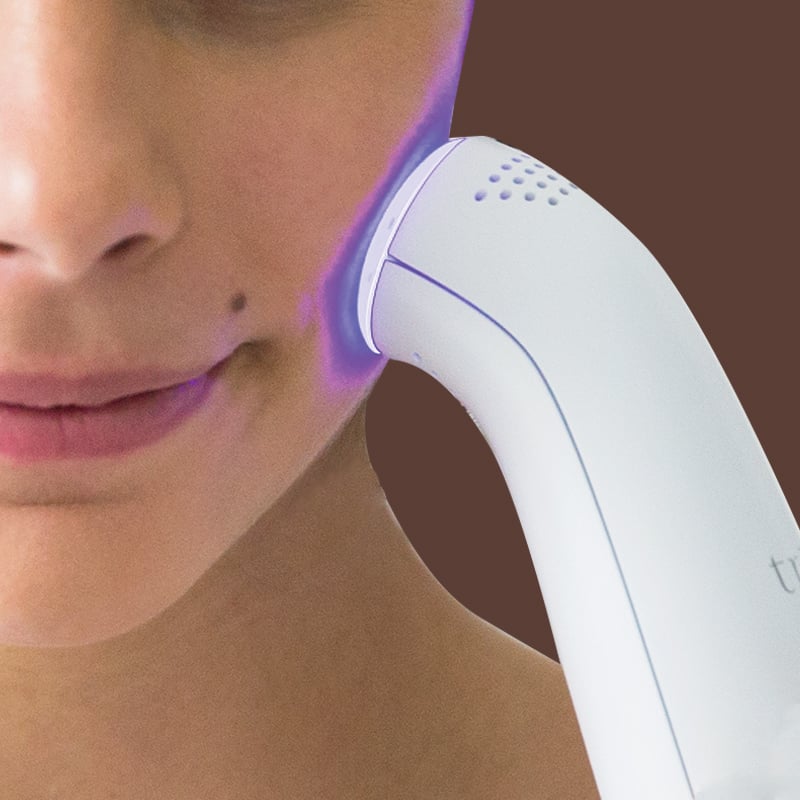Why blue light therapy for acne was the end to my 20year skin battle