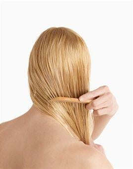 Alopecia areata causes symptoms treatment