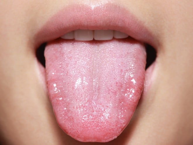 Your tongue may have a lot to say about your health.