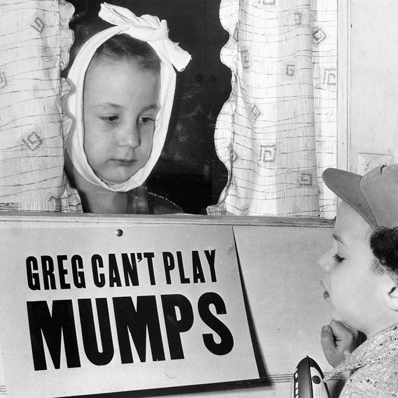 Should you be worried about mumps? Here's what you need to know