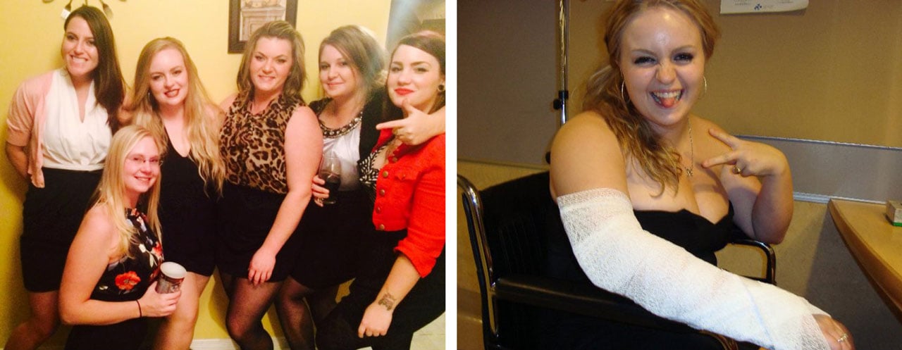 (Left) Nicole stands with her friends on the night she broke her arm. (Right) Nicole sits with her arm in a cast.