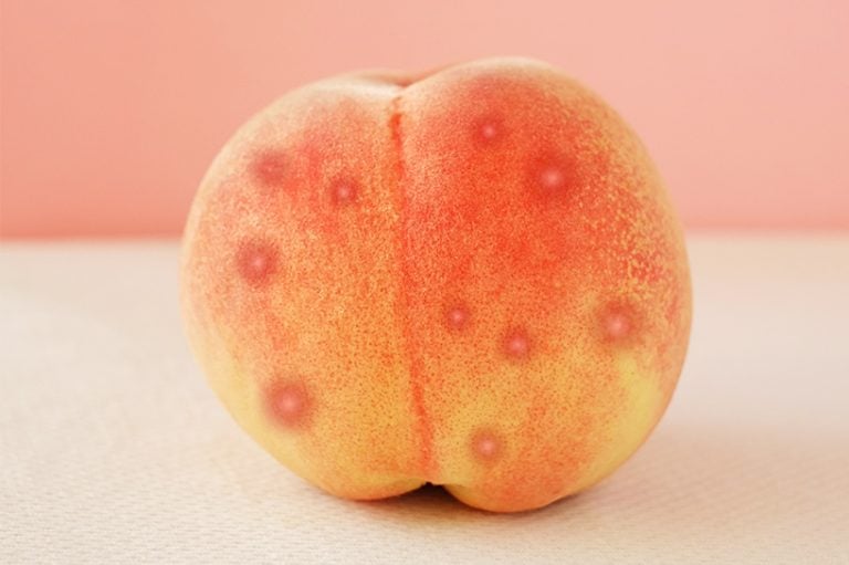 How Do I Get Rid Of Acne…On My Butt?