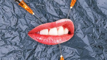 does botox affect mood? image of mouth cut out with needles injecting it
