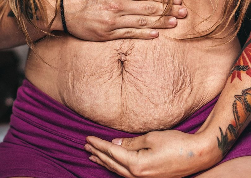 real mom bodies photo shows a woman holding her tummy with some extra skin ...