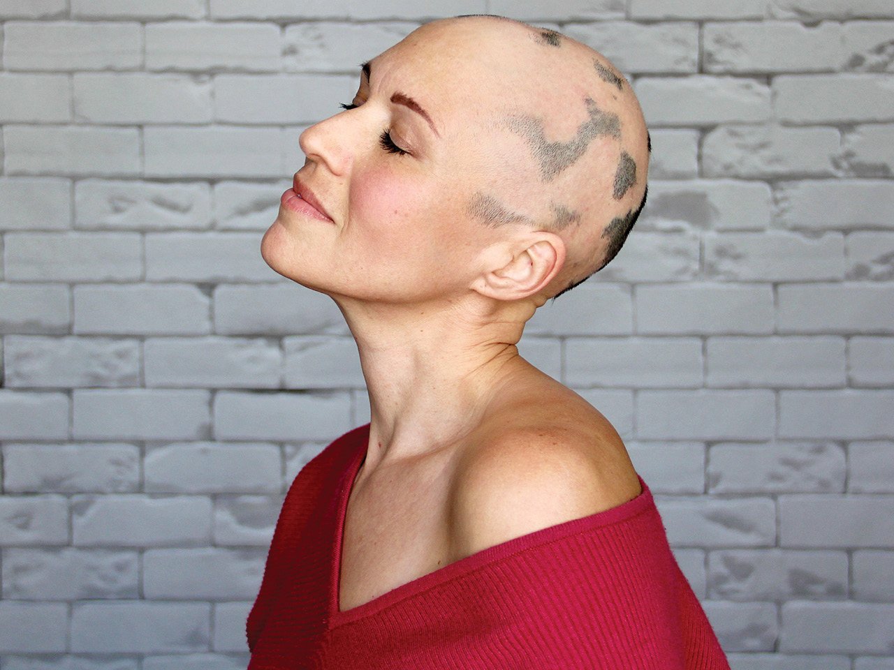 A photo of Anne-Lise Nadeau after she shaved her head following her experience with alopecia areata.