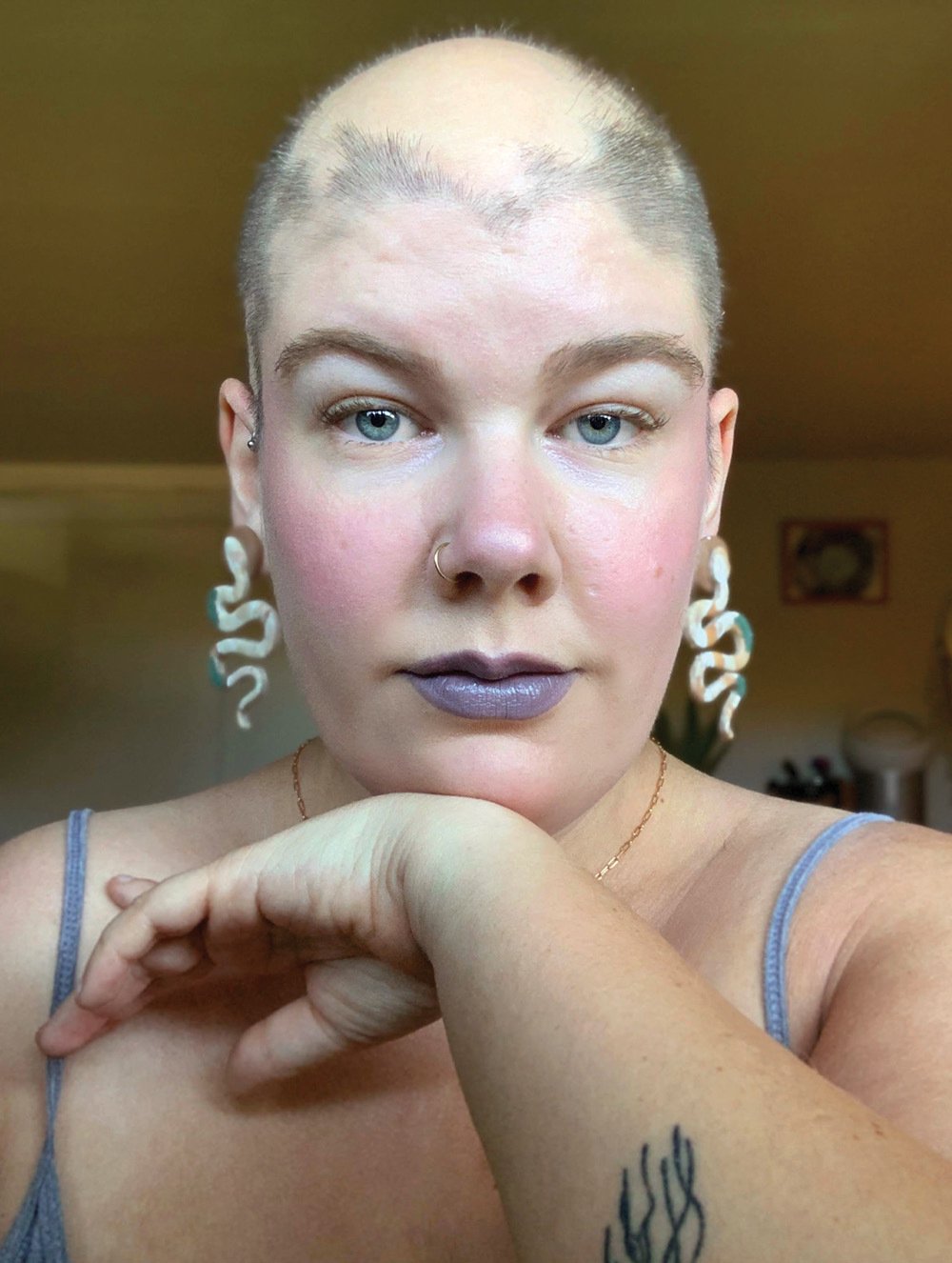 A photo of Brianne Cail after she shaved her head following her experience with alopecia areata.